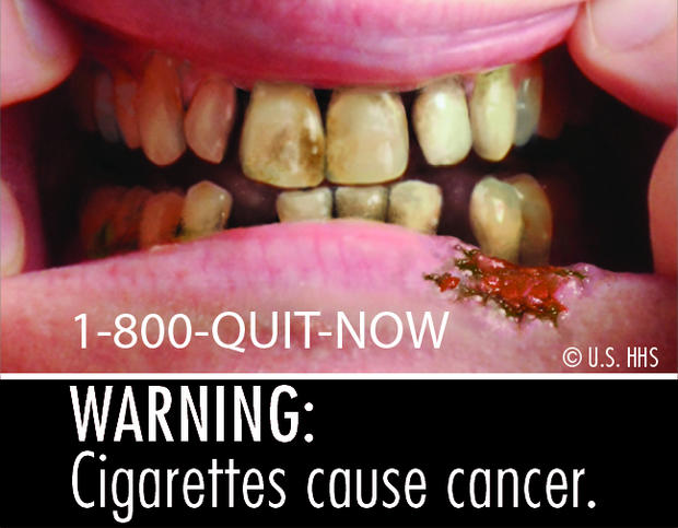Cigarettes cause cancer 