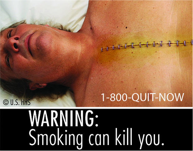 cigarette_health_warning_07-1B.jpg 