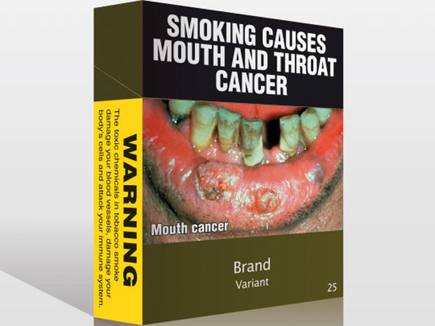 Pack of Australian cigarettes shows graphic images of effects of tobacco 