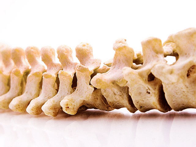 bones, spinal cord, spine, bone, vertebrae, stock, 4x3 
