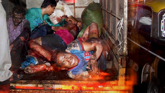 Injured victims of a bomb explosion are loaded onto a truck to be taken to hospital 