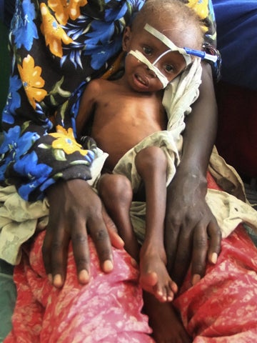 somalia_famine_8_AP110726117606.JPG 