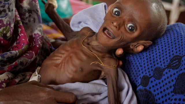 East Africa famine 