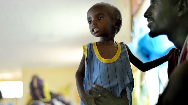 Somalia famine 