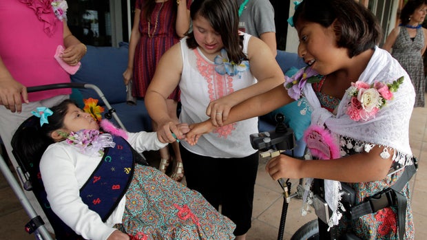 Mel Gibson at party for formerly conjoined twins