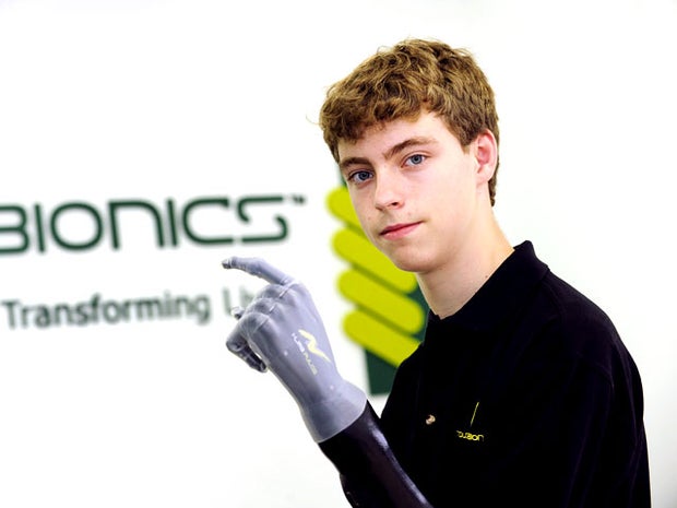 touchbio, bionic arm, matthew james, f1, mercedes, prosthetic