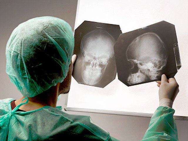 brain, surgeon, surgery, xrays, neuroscience, neurosurgery, stock, 4x3 