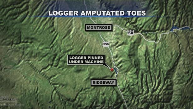 LOGGER AMPUTATED TOES MAP.C 