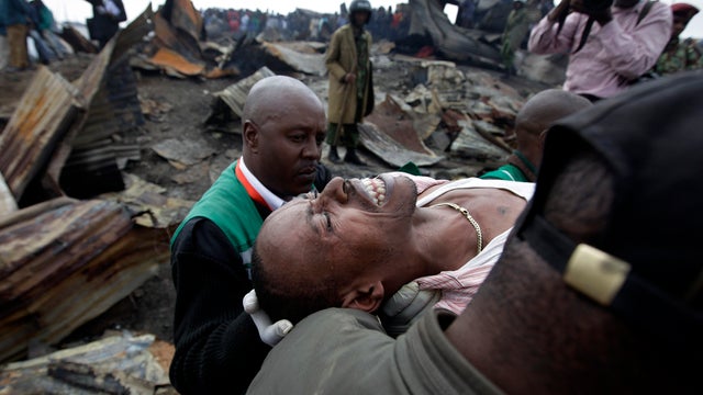 Joseph Mwangi, 34, is carried away in a state of shock by ambulance workers after discovering the charred remains of two of his children, one of which was 6-years-old, at the scene of a gasoline pipeline explosion in Nairobi, Kenya, Sept. 12, 2011. A leak 