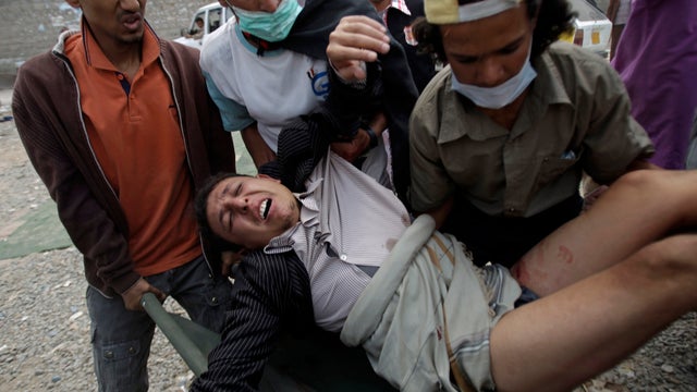 Yemen wounded protester 