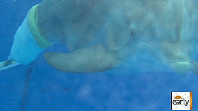 Winter wearing her prosthetic 