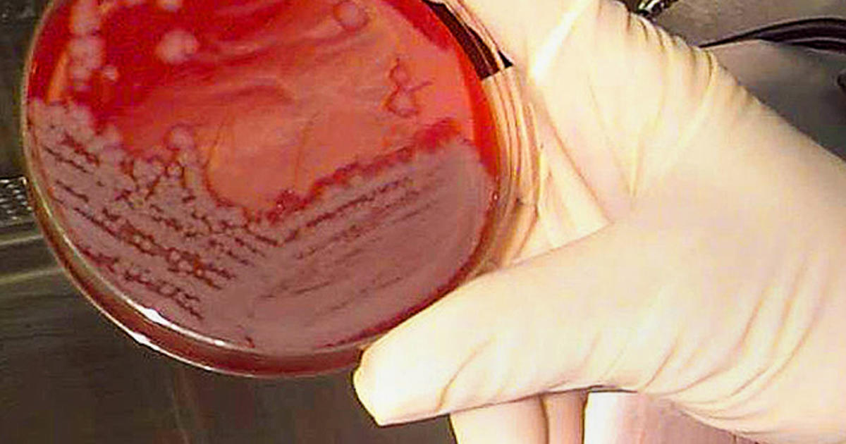 No Sign Of Anthrax Infections After CDC Lab Incident - CBS News