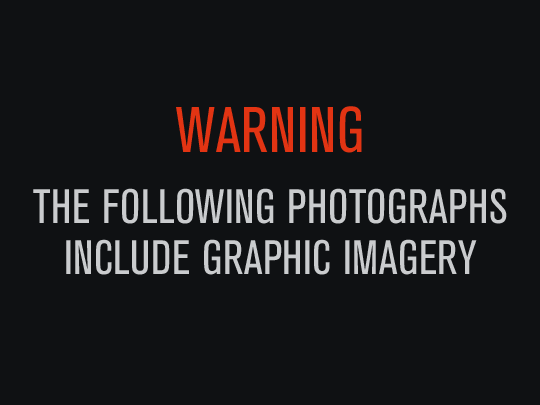 Graphic Image Warning 