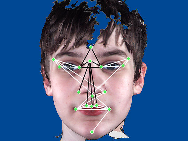 autism, facial features 