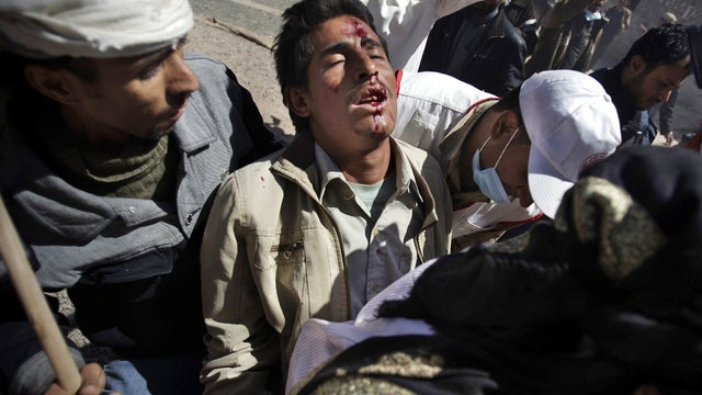 A wounded Yemeni protester is carried from the site of clashes with security forces in Sanaa, Yemen, Oct. 25, 2011. Yemeni troops loyal to embattled President Ali Abdullah Saleh opened fire at thousands of protesters calling for his ouster in the capital, 