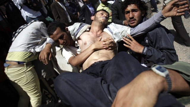 A wounded Yemeni protester is carried from clashes with security forces in Sanaa, Yemen, Oct. 25, 2011. 