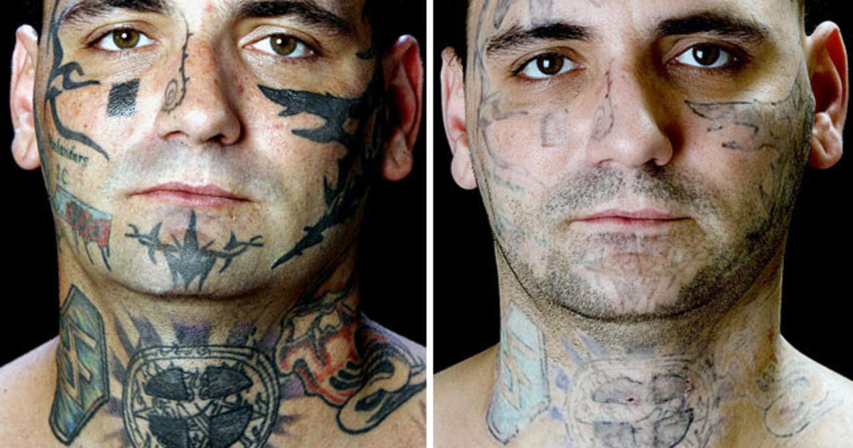 FDA: Tattoo removal no simple process - CBS News