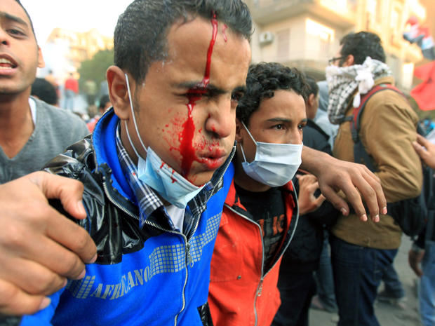 An injured Egyptian protester is helped away during a third consecutive day of clashes with security forces Nov. 21, 2011, at Tahrir Square in Cairo. Fresh clashes erupted between police and protesters demanding the end of army rule as the ruling military council faced its worst crisis since Hosni Mubarak was toppled. 