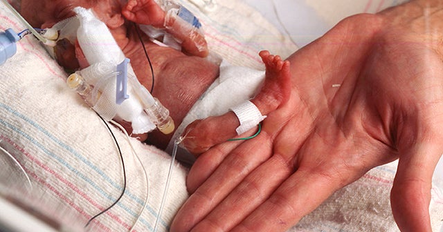 World's tiniest babies: How are they now?