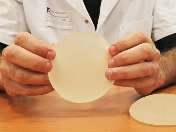 France calls for removal of thousands of breast implants 