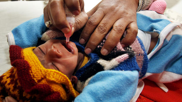 Poliomyelitis: 24 photos of crippling disease 