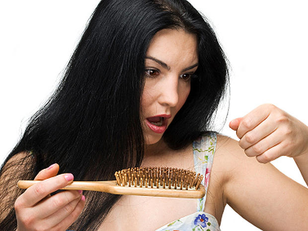 women's hair loss 