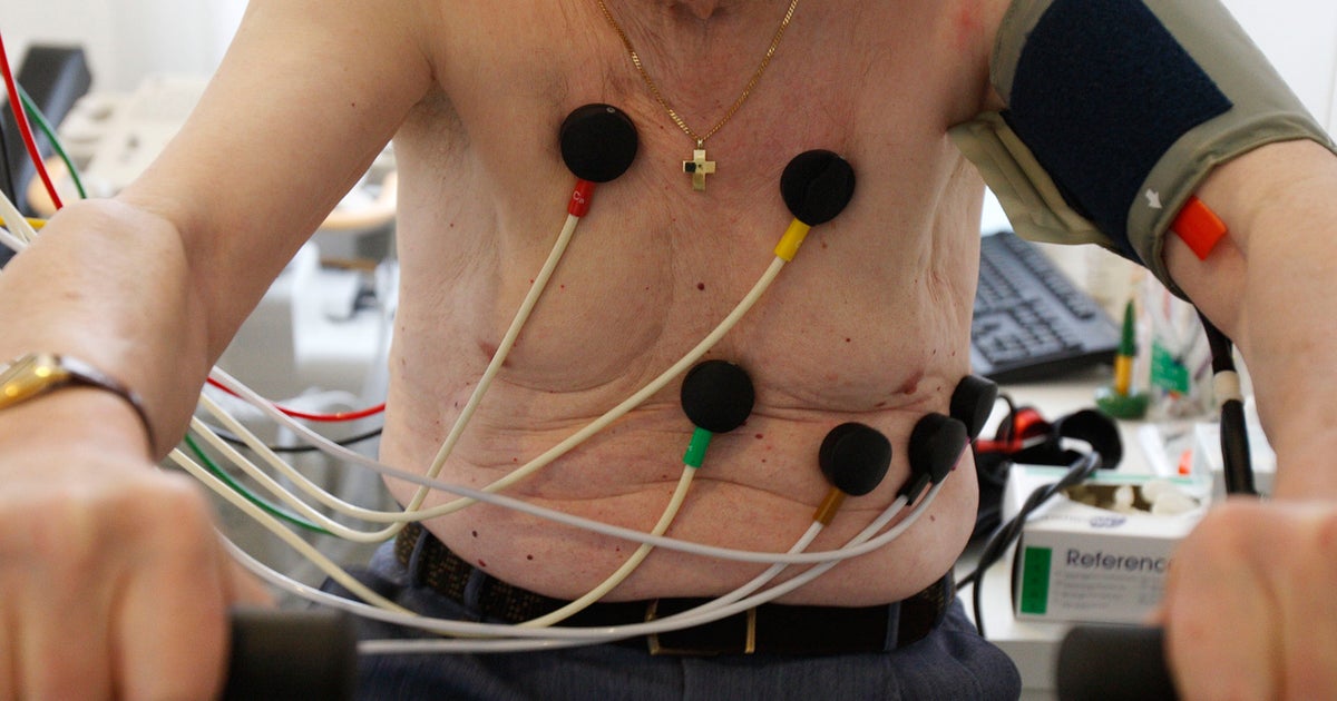 Healthy people should skip EKG screening, say new U.S. Preventive ...