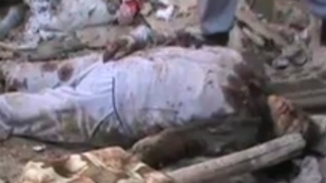 Alleged victim of Syrian government bombardment of Homs 