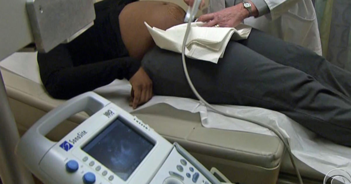 Is A Required Ultrasound A Barrier To Abortion? - Cbs News