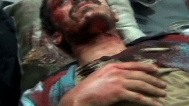 Desperate situation facing Syria's wounded 