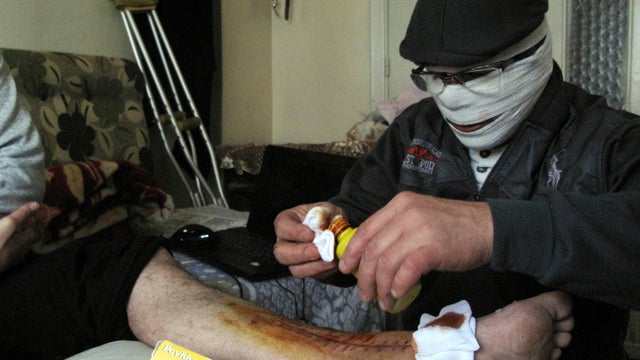 Injured man gets treated in Syria 