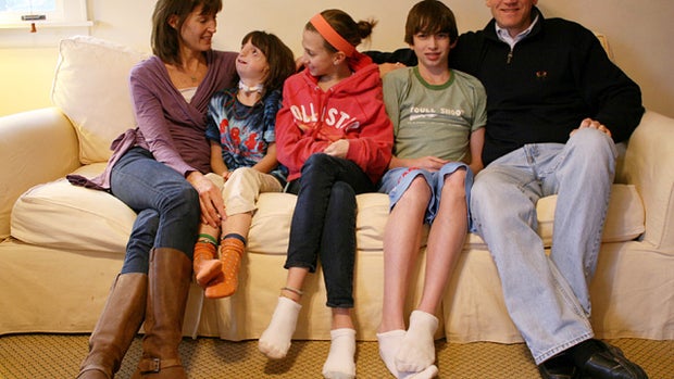 Clara's journey: 9-year-old with deformed face navigates the world 