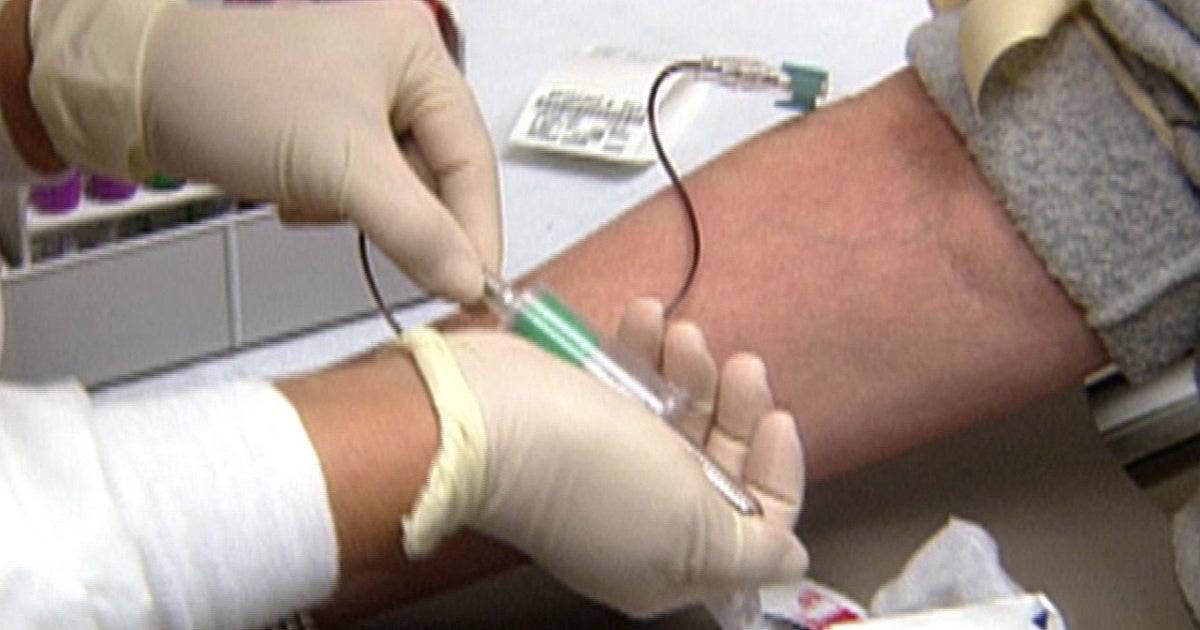 Fasting may not be necessary before cholesterol test CBS News