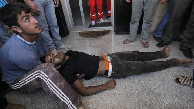 A Syrian injured man who was shot in his leg by the Syrian border guard when he was crossing a river from Syria into Lebanon 