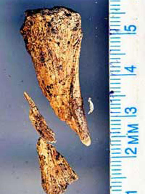 Bone fragment found by TIGHAR 