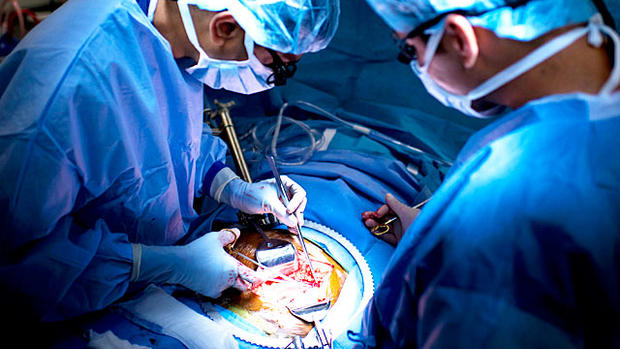 Inside look at kidney transplant (GRAPHIC IMAGES) 