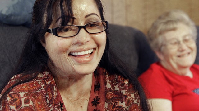 Julie Aftab, a Pakistani refugee, and Gloria Ervin share a laugh as they talk at their home Wednesday, July 4, 2012, in Houston. Gloria and her husband, Lee Ervin, are the host family for Julie Aftab, who was attacked in Pakistan with acid because she was 