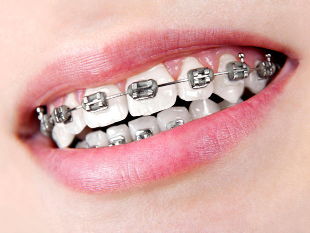 7 troublesome ways teens destroy their teeth 