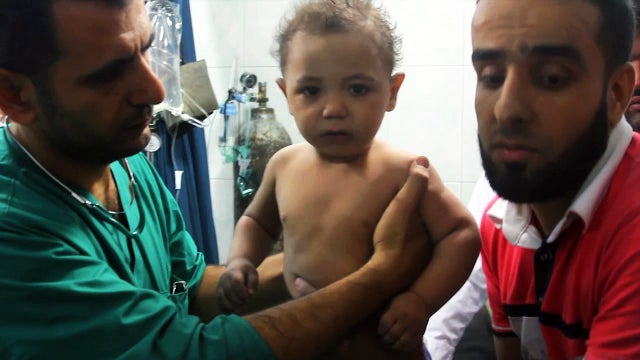 Syrian child survives blast that killed entire family 