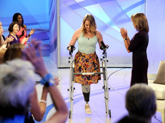 Aimee Copeland appears on talk show to discuss battle with flesh-eating