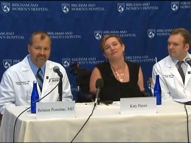 katy hayes, double arm transplant, brigham and women's hospital 