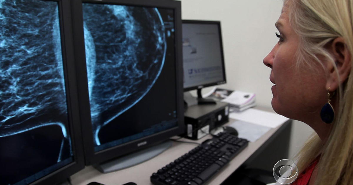 Mammograms May Save One Life For Every Three Women Overdiagnosed Cbs News