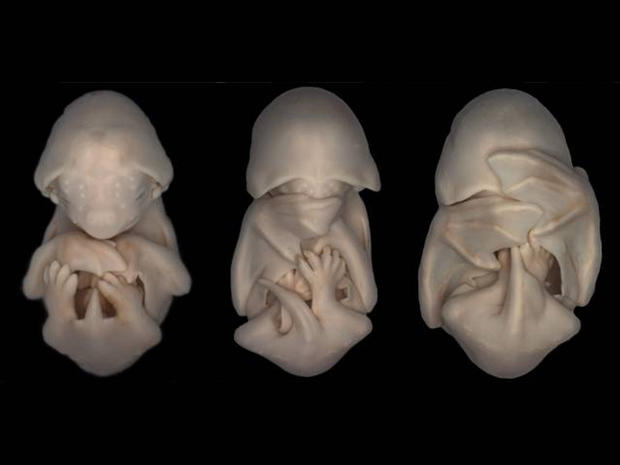 Embryos of the species Molossus rufus, the black mastiff bat. These images formed part of an embryonic staging system for this species. 