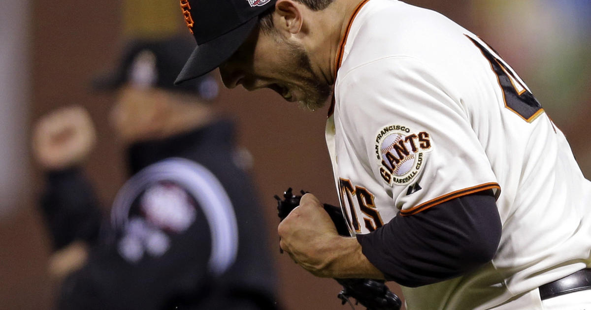 World Series Game 2 preview: Madison Bumgarner vs. Doug Fister 