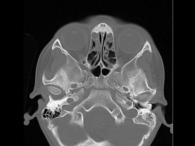 tooth, ear, x-ray, scans 