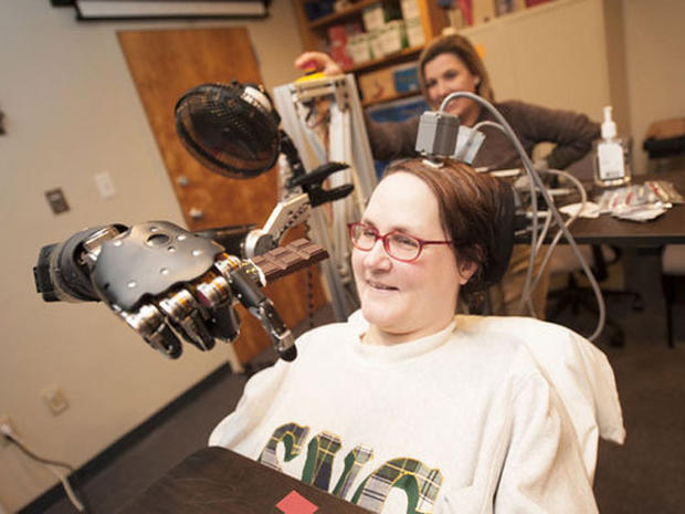 Jan Scheuermann, who has quadriplegia, brings a chocolate bar to her mouth using a robot arm she is guiding with her thoughts. 