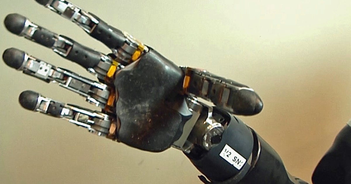 Trying a new arm on for size - CBS News