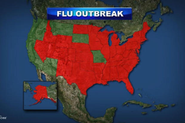 flu-map 