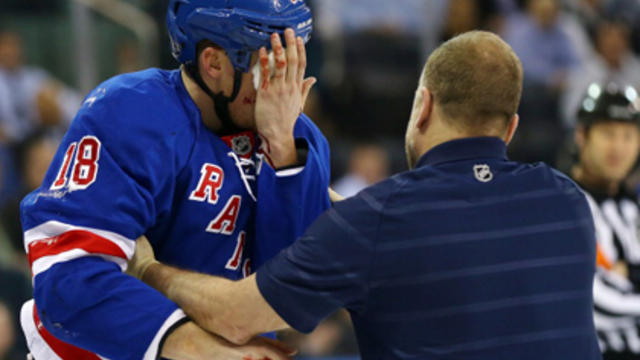 marc-staal-takes-puck-to-face.jpg 