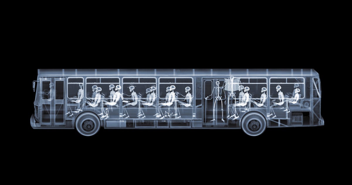 Incredible x-ray art